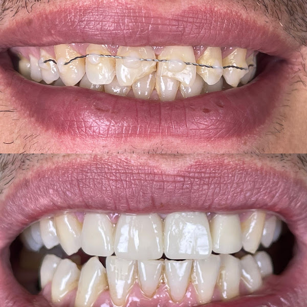 Adriadent, klinikë dentare në Shkodër – foto 2