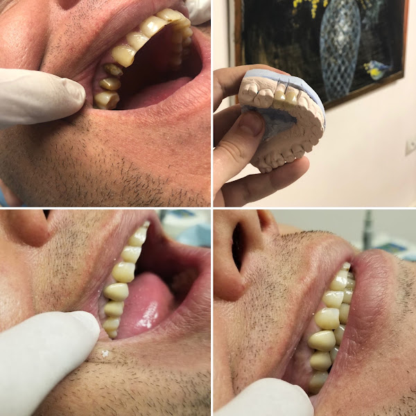 Duraj Dental, clinica dentale a Tirana – foto 2