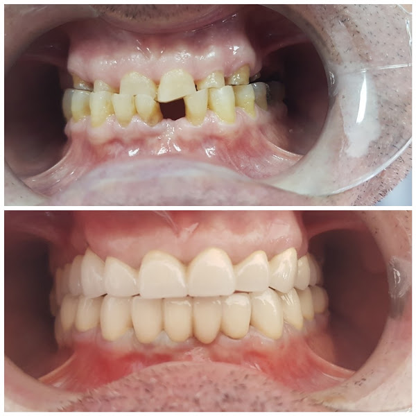 Klinika Dentare Il Dent, clinica dentale a Fier – foto 2