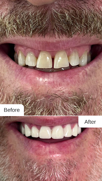 KissDent Dental Clinic, clinica dentale a Tirana – foto 3