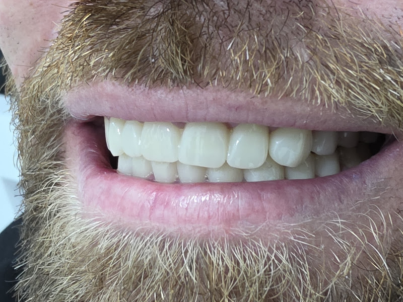 European Dental Clinic, klinikë dentare në Elbasan – foto 2