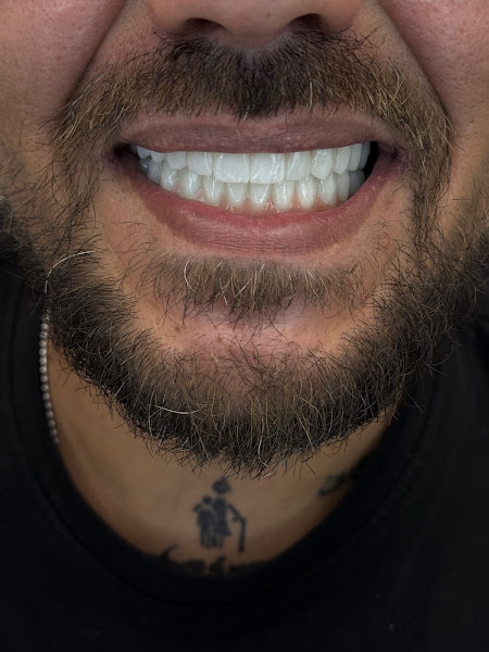 Lela Dental, clinica dentale a Tirana – foto 2