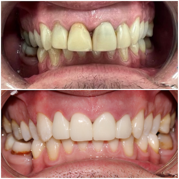 Diplomat Dental