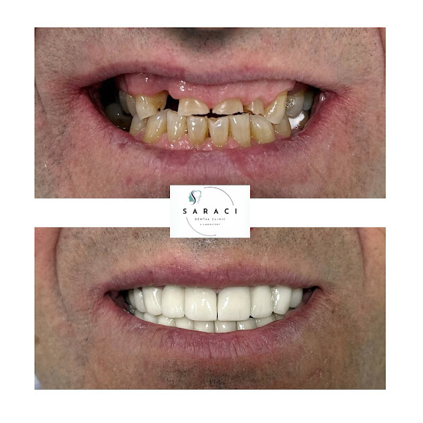Saraci Dental Clinic, clinica dentale a Elbasan – foto 2