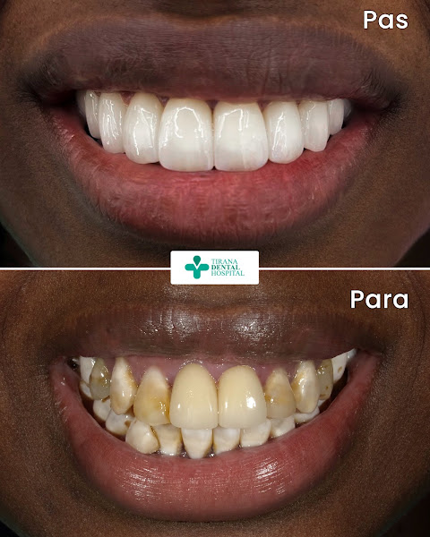 Tirana Dental Hospital, klinikë dentare në Tiranë – foto 2