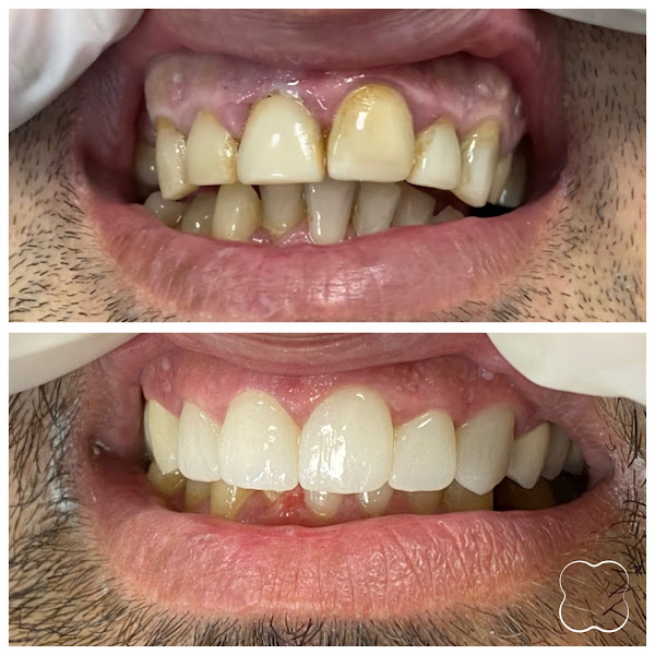Diplomat Dental, klinikë dentare në Tiranë – foto 2