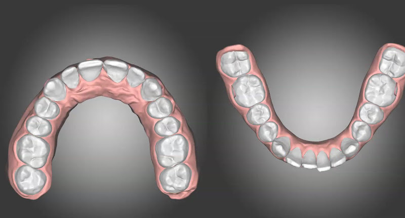 Medicus Dental Clinic, klinikë dentare në Shkodër – foto 3