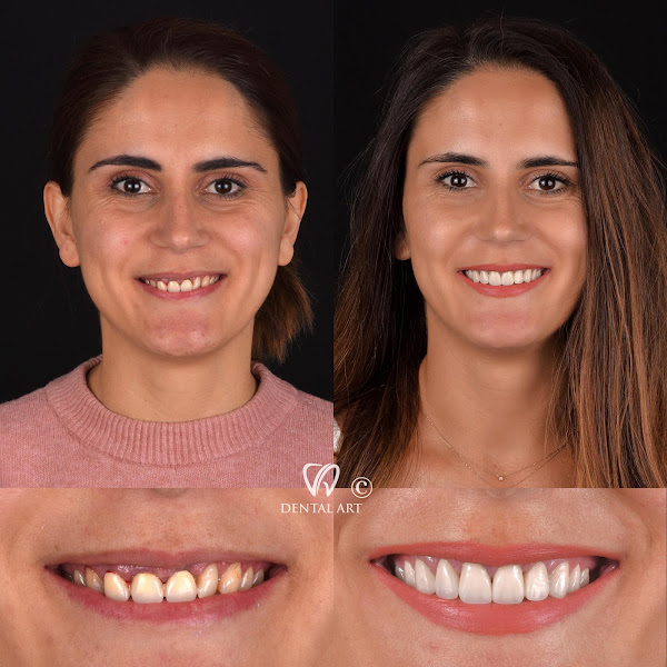 Dental Art Tirana