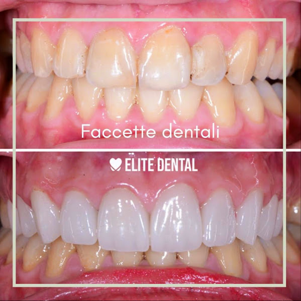 Elite Dental