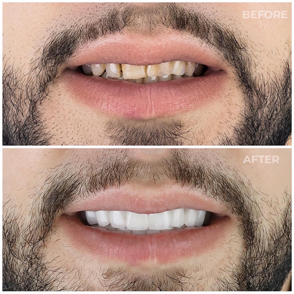 Dental Tirana, dental clinic in Tirana – photo 2