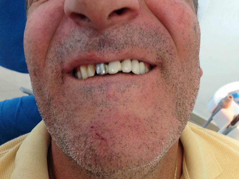 Lilaj Dental, clinica dentale a Berat – foto 3