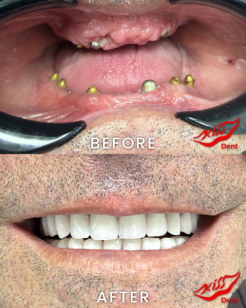 KissDent Dental Clinic, clinica dentale a Tirana – foto 2