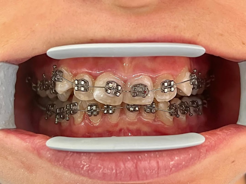 Gëzimi Dent, klinikë dentare në Durrës – foto 2