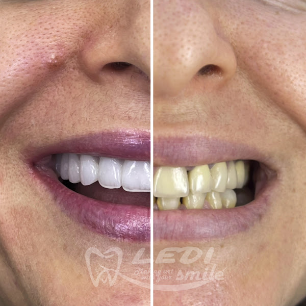 Klinika Dentare Ledismile, clinica dentale a Tirana – foto 3