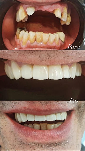 Confident Dental Clinic, clinica dentale a Elbasan – foto 2