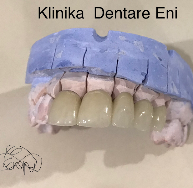 Klinika Dentare Eni, klinikë dentare në Berat – foto 2