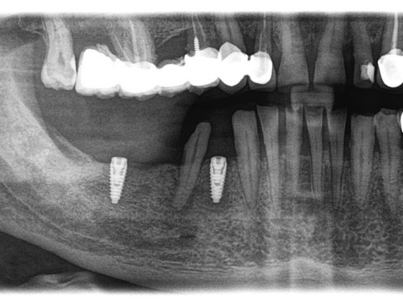 IBS Dental Clinic, klinikë dentare në Fier – foto 2