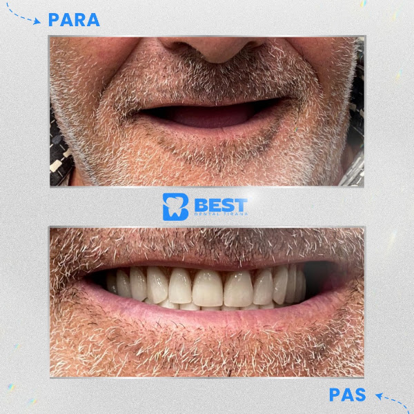 Best Dental Tirana, dental clinic in Tirana – photo 2