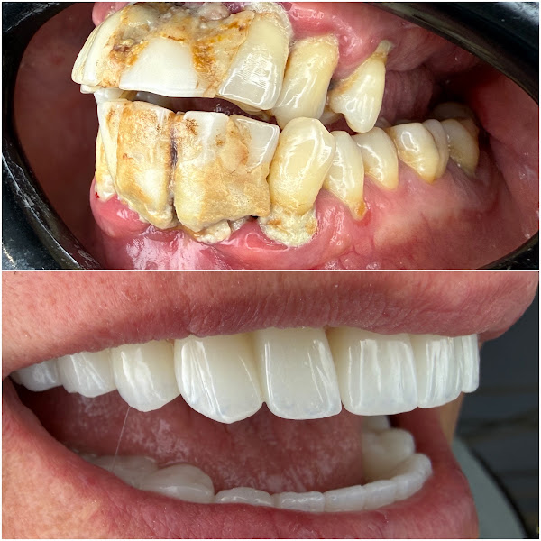 Dental Center Albania (DCA)
