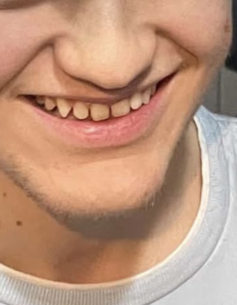 Odonto Derma Clinic, klinikë dentare në Durrës – foto 2