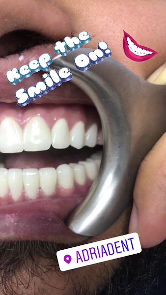 Adriadent, klinikë dentare në Shkodër – foto 3