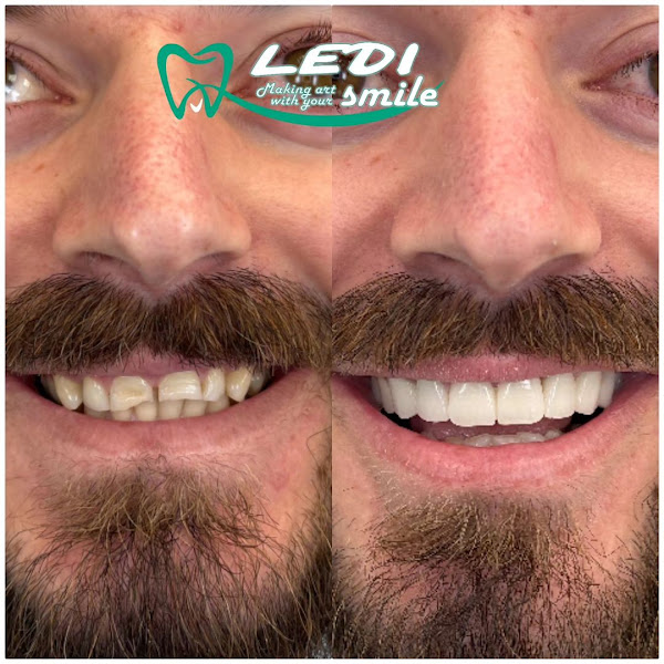 Klinika Dentare Ledismile, clinica dentale a Tirana – foto 2