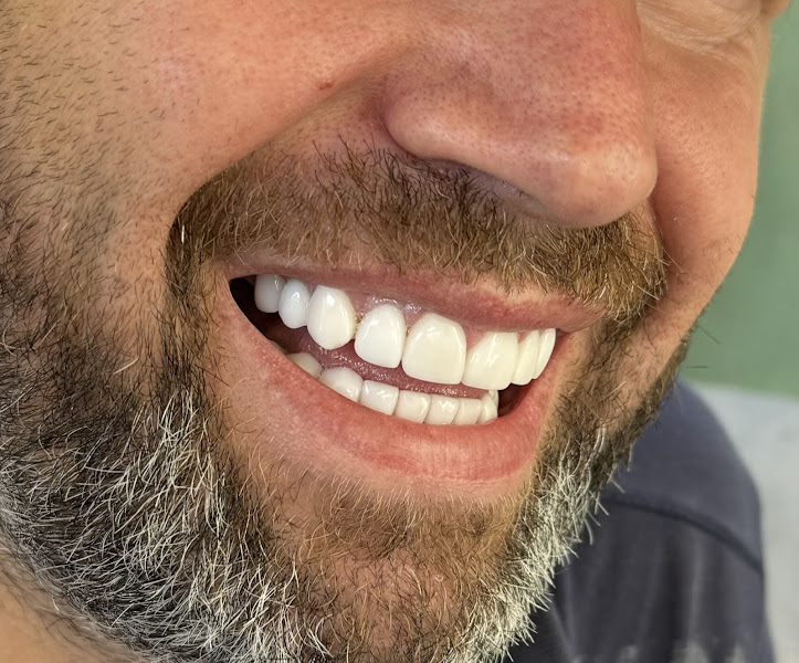 Qato Dental, klinikë dentare në Berat – foto 2