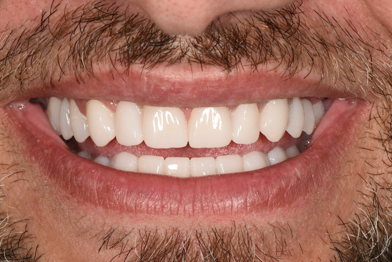 Dental House, clinica dentale a Elbasan – foto 2