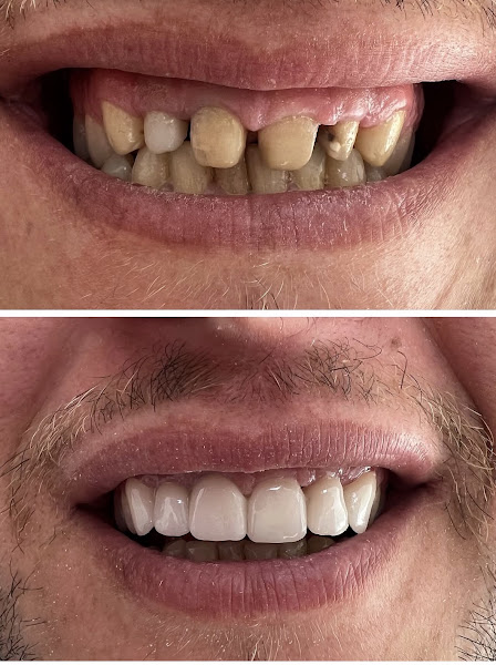Klinika OrthoLove, clinica dentale a Saranda – foto 2