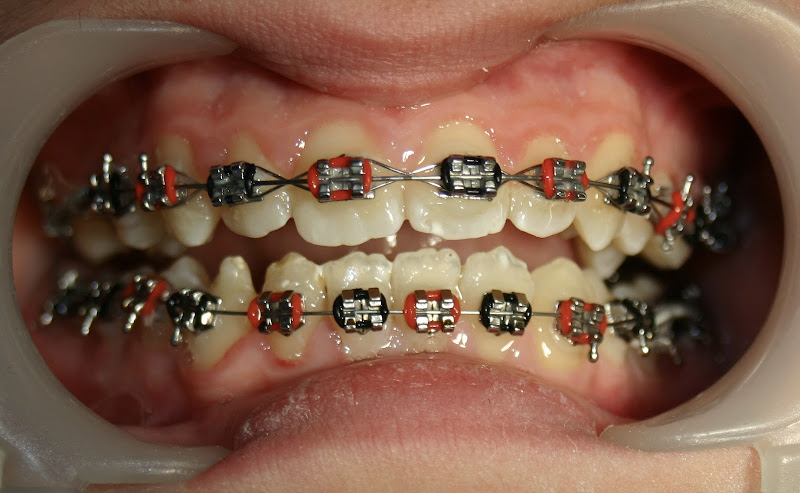 Marubi Dental Center, clinica dentale a Scutari – foto 2