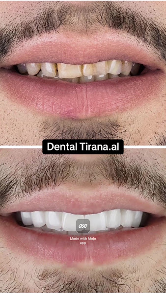 Dental Tirana, dental clinic in Tirana – photo 3