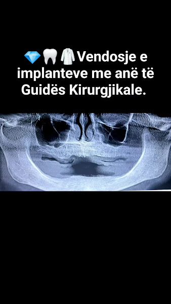 White Dent – Dr. Herion Koço Prifti, clinica dentale a Coriza – foto 3