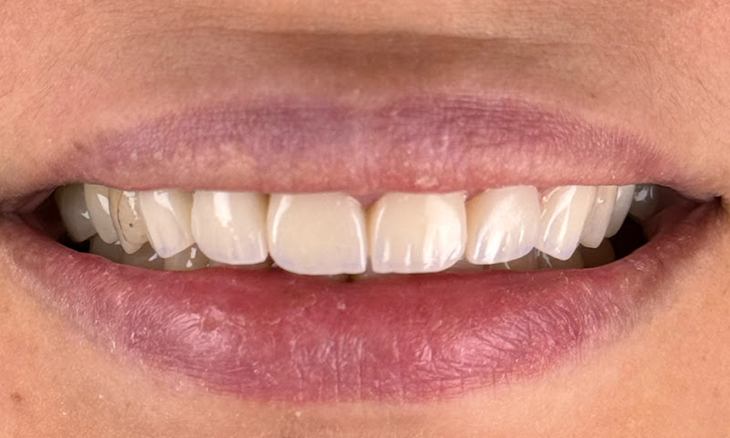 Family Dental Fier