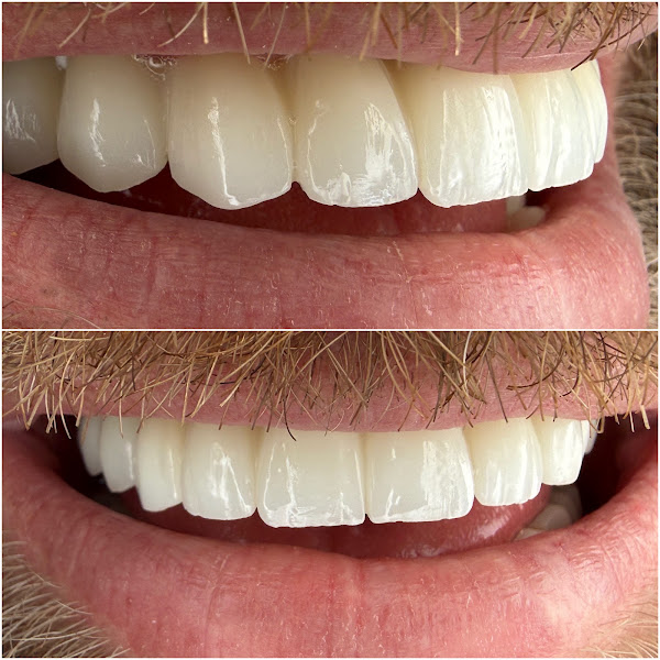 Dental Center Albania (DCA), dental clinic in Tirana – photo 2