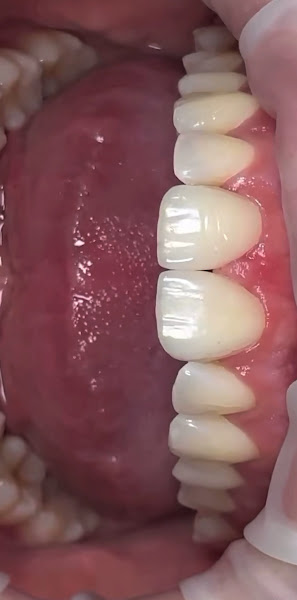 Progonati Dental, clinica dentale a Fier – foto 3