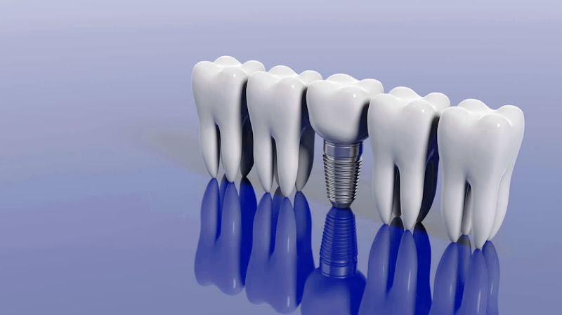 Lilaj Dental, clinica dentale a Berat – foto 2